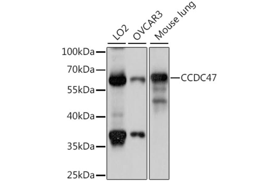 Western Blot - Anti-CCDC47 Antibody (A90679) - Antibodies.com