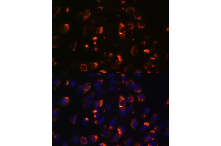 Immunofluorescence - Anti-CCDC47 Antibody (A90679) - Antibodies.com