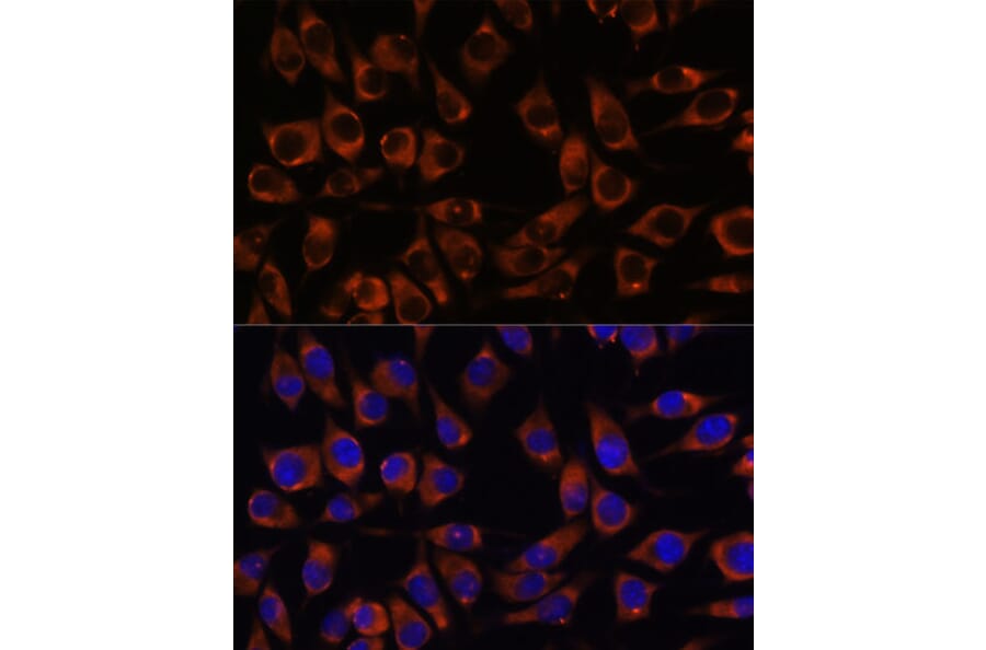 Immunofluorescence - Anti-CCDC47 Antibody (A90679) - Antibodies.com