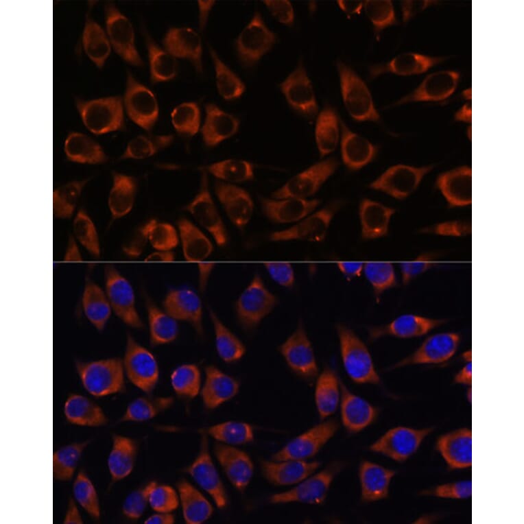 Immunofluorescence - Anti-CCDC47 Antibody (A90679) - Antibodies.com
