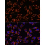Immunofluorescence - Anti-CCDC47 Antibody (A90679) - Antibodies.com