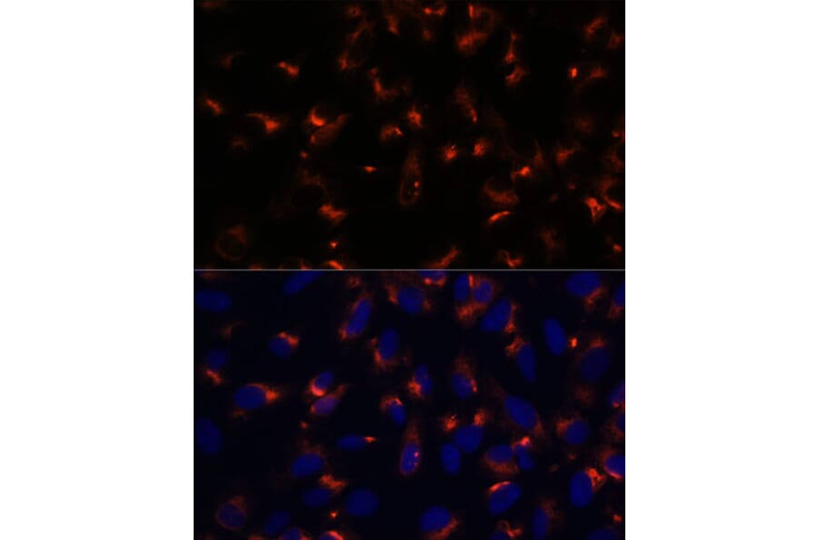 Immunofluorescence - Anti-CCDC47 Antibody (A90679) - Antibodies.com