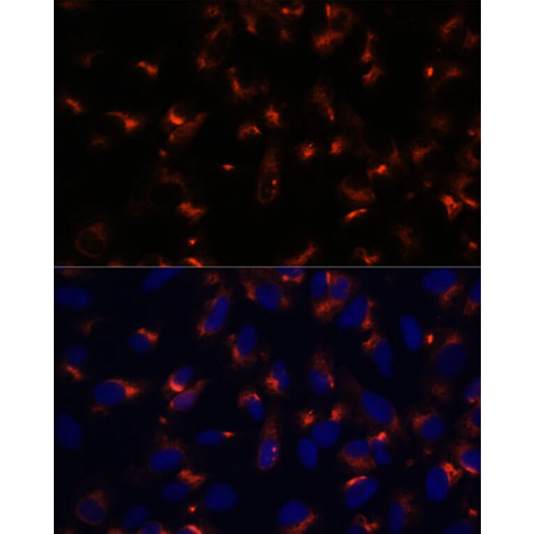 Immunofluorescence - Anti-CCDC47 Antibody (A90679) - Antibodies.com