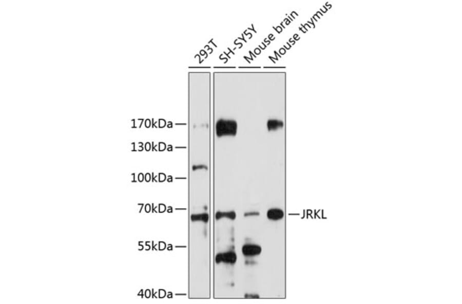 Western Blot - Anti-JRKL Antibody (A90680) - Antibodies.com