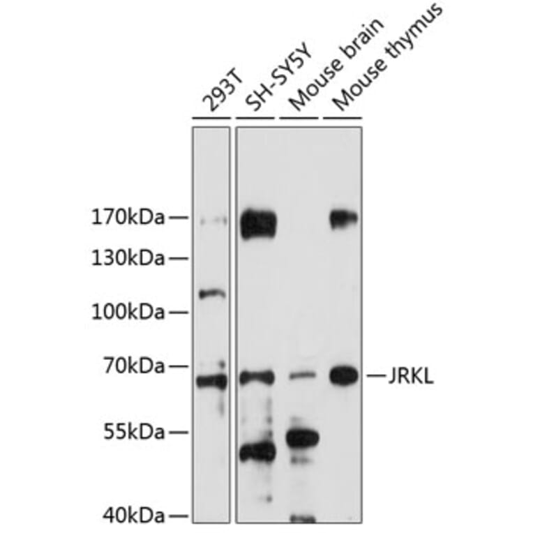 Western Blot - Anti-JRKL Antibody (A90680) - Antibodies.com