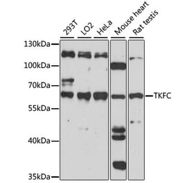 Western Blot - Anti-DAK Antibody (A90681) - Antibodies.com