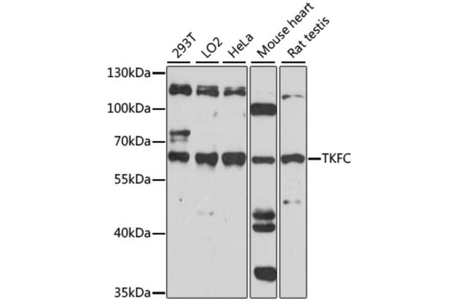 Western Blot - Anti-DAK Antibody (A90681) - Antibodies.com