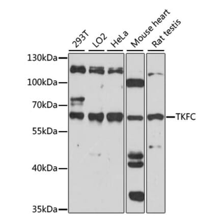 Western Blot - Anti-DAK Antibody (A90681) - Antibodies.com