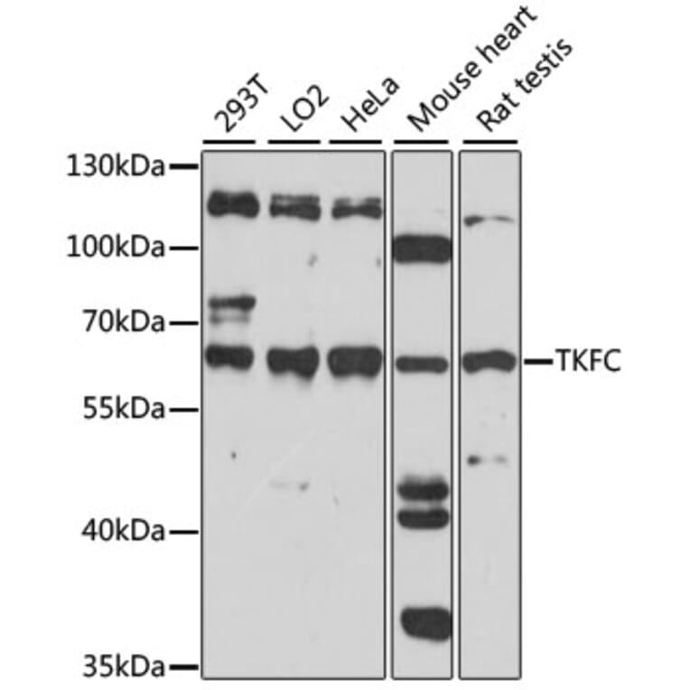 Western Blot - Anti-DAK Antibody (A90681) - Antibodies.com