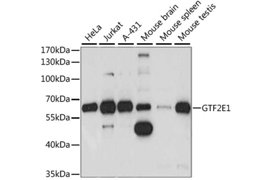 Western Blot - Anti-TFIIE alpha/GTF2E1 Antibody (A90682) - Antibodies.com