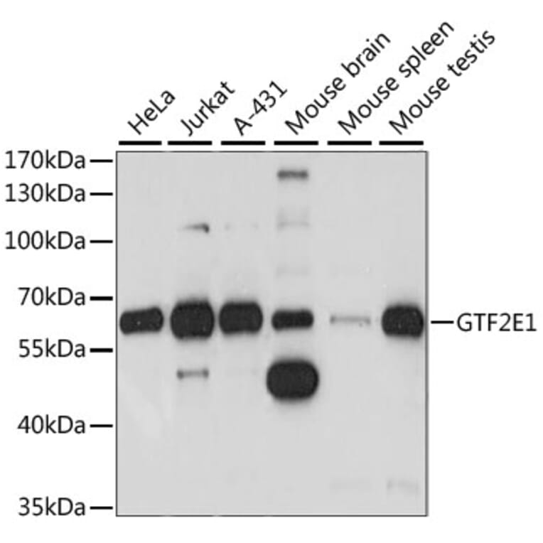 Western Blot - Anti-TFIIE alpha/GTF2E1 Antibody (A90682) - Antibodies.com