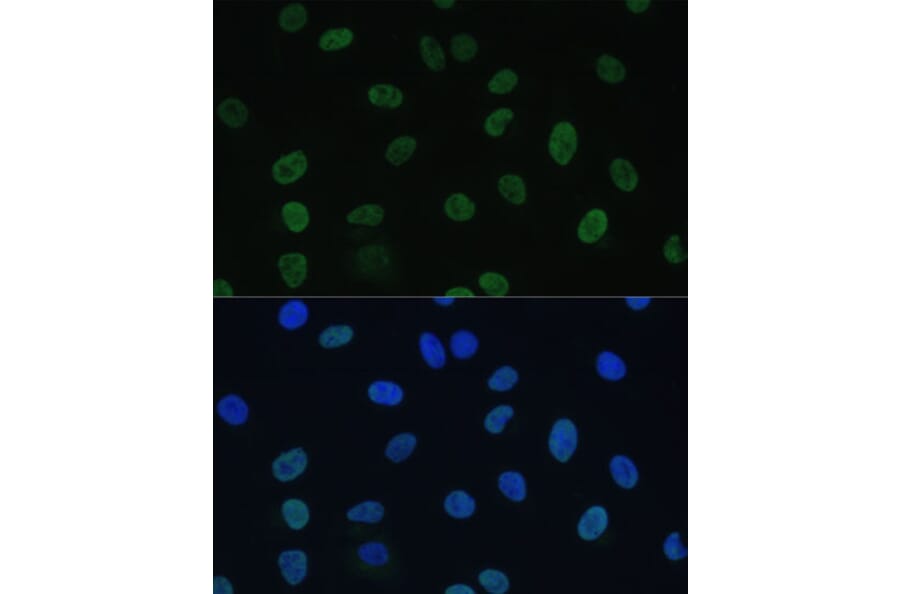 Immunofluorescence - Anti-TFIIE alpha/GTF2E1 Antibody (A90682) - Antibodies.com