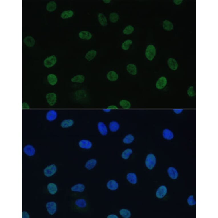 Immunofluorescence - Anti-TFIIE alpha/GTF2E1 Antibody (A90682) - Antibodies.com