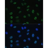 Immunofluorescence - Anti-TFIIE alpha/GTF2E1 Antibody (A90682) - Antibodies.com