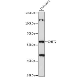 Western Blot - Anti-CHST2 Antibody (A90683) - Antibodies.com