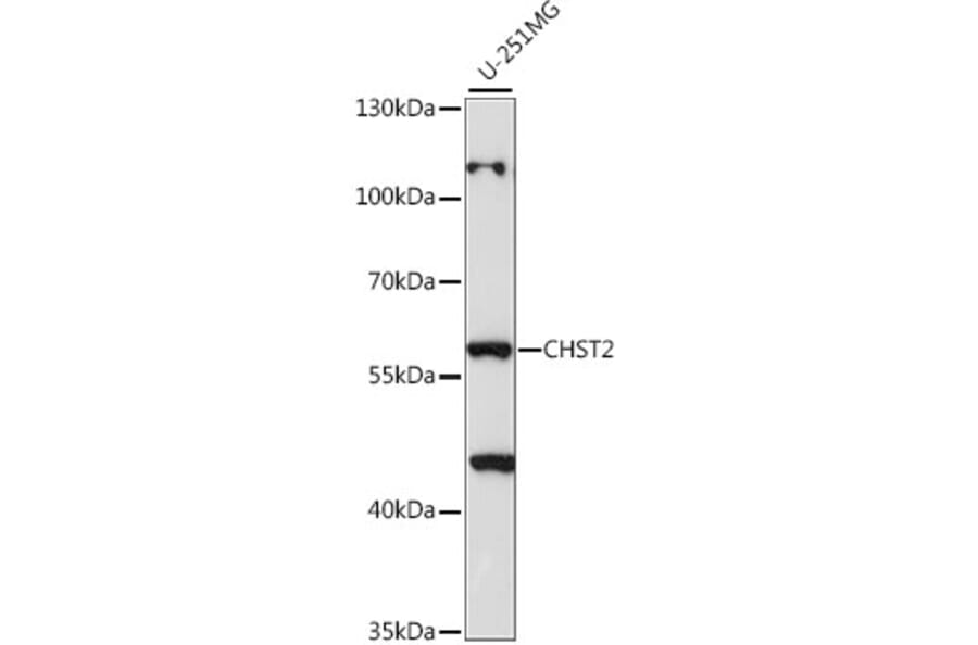 Western Blot - Anti-CHST2 Antibody (A90683) - Antibodies.com