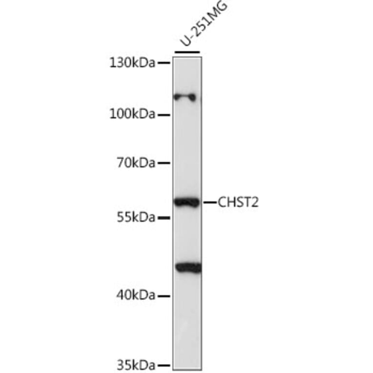 Western Blot - Anti-CHST2 Antibody (A90683) - Antibodies.com