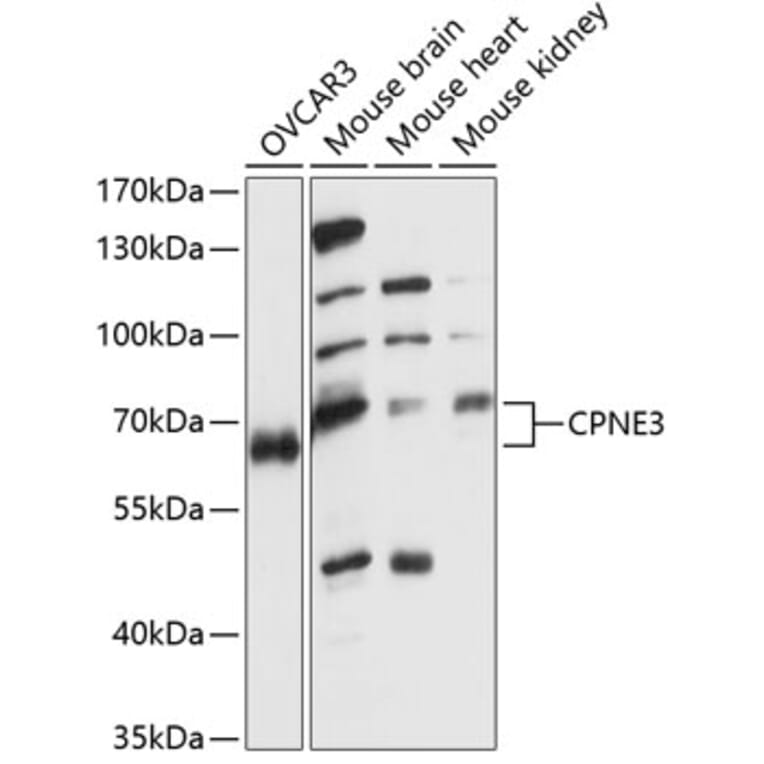Western Blot - Anti-CPNE3 Antibody (A90684) - Antibodies.com