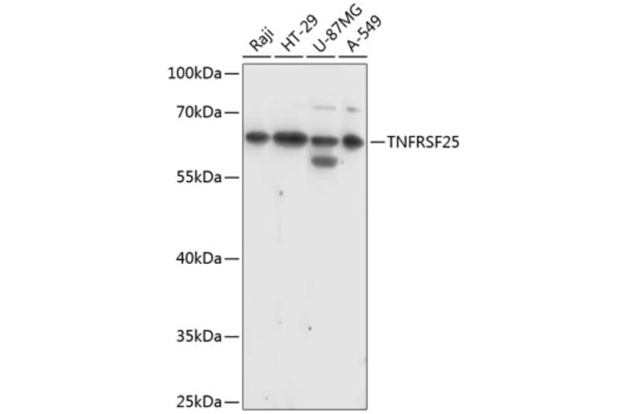 Western Blot - Anti-DR3/LARD Antibody (A90685) - Antibodies.com
