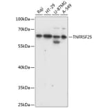 Western Blot - Anti-DR3/LARD Antibody (A90685) - Antibodies.com