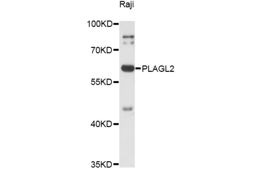 Western Blot - Anti-PLAGL2 Antibody (A14318) - Antibodies.com