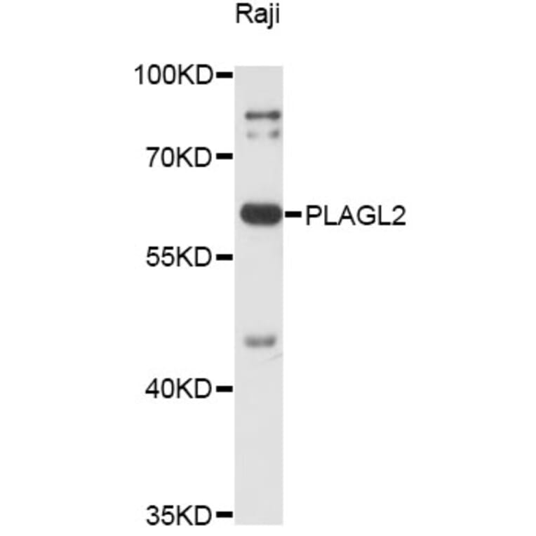 Western Blot - Anti-PLAGL2 Antibody (A14318) - Antibodies.com