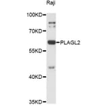 Western Blot - Anti-PLAGL2 Antibody (A14318) - Antibodies.com
