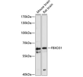 Western Blot - Anti-FBXO31 Antibody (A90687) - Antibodies.com