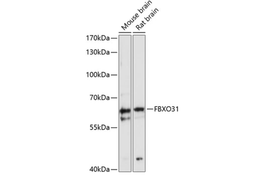Western Blot - Anti-FBXO31 Antibody (A90687) - Antibodies.com
