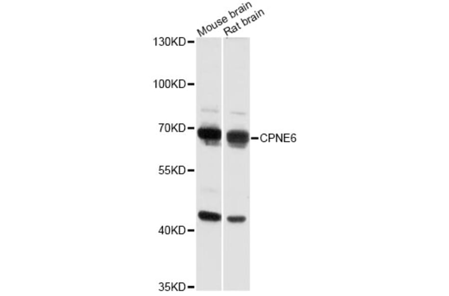 Western Blot - Anti-CPNE6 Antibody (A14385) - Antibodies.com