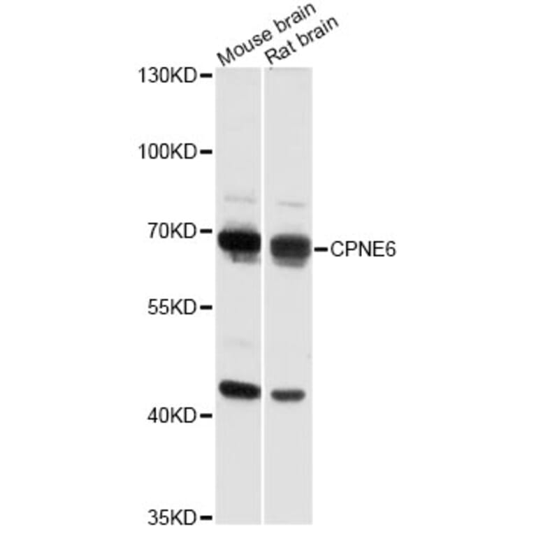 Western Blot - Anti-CPNE6 Antibody (A14385) - Antibodies.com