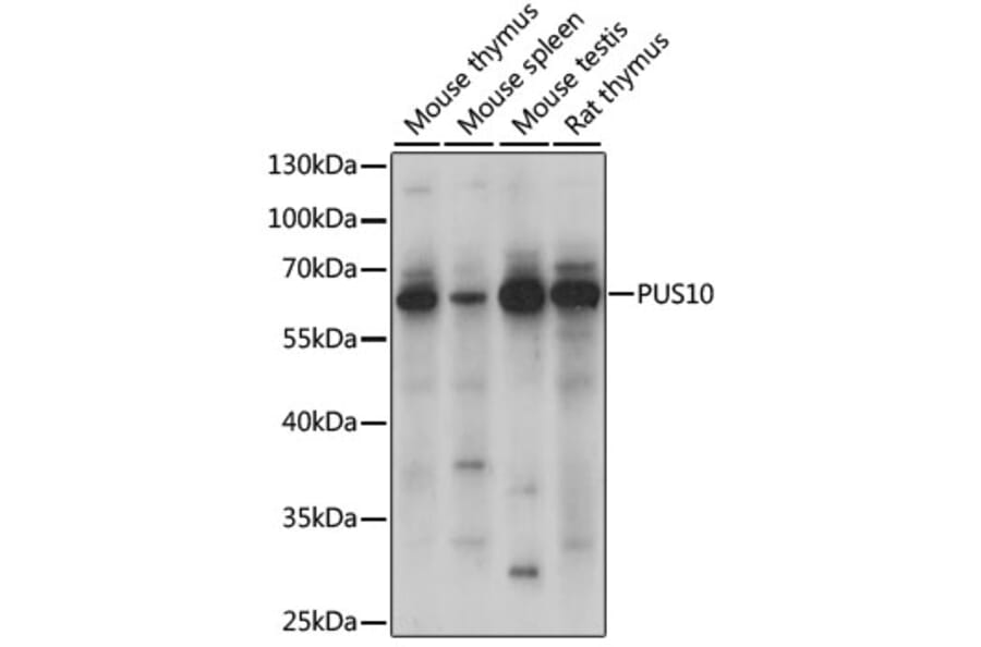 Western Blot - Anti-PUS10 Antibody (A90691) - Antibodies.com