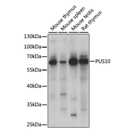 Western Blot - Anti-PUS10 Antibody (A90691) - Antibodies.com