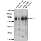 Western Blot - Anti-PUS10 Antibody (A90691) - Antibodies.com