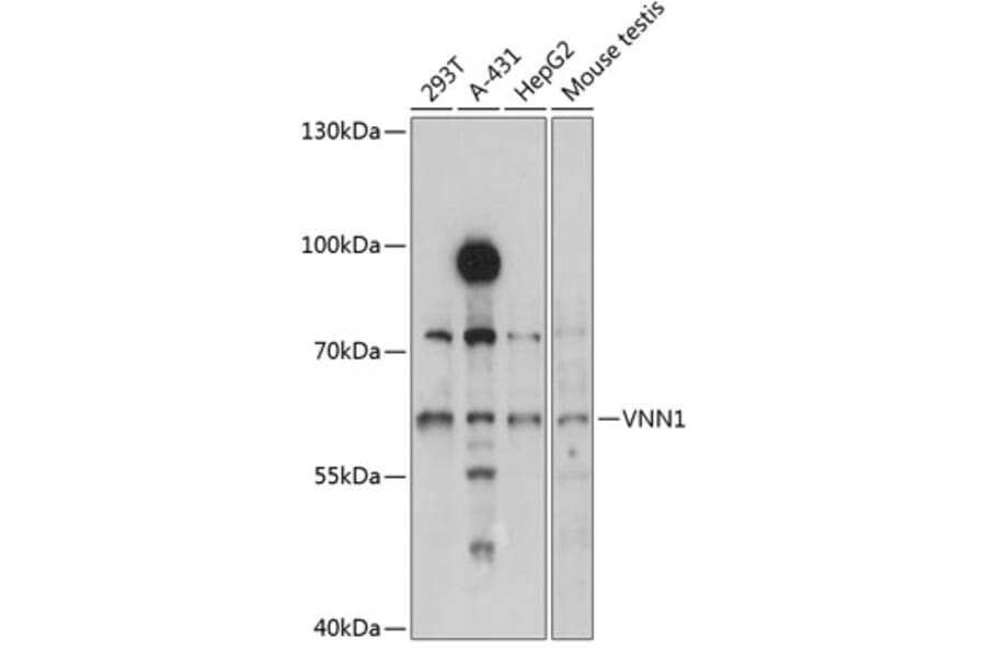 Western Blot - Anti-VNN1/Vanin-1 Antibody (A90693) - Antibodies.com