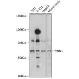 Western Blot - Anti-VNN1/Vanin-1 Antibody (A90693) - Antibodies.com