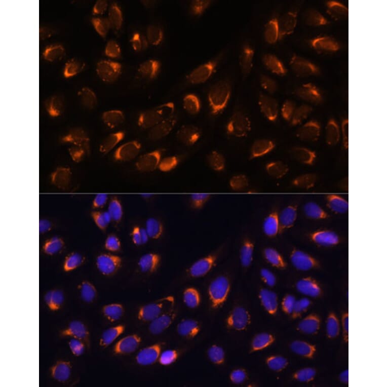 Immunofluorescence - Anti-NUCB1 Antibody (A90694) - Antibodies.com