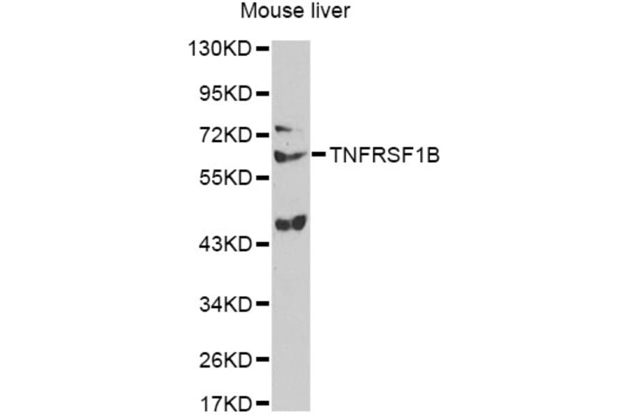Western Blot - Anti-TNFRSF1B Antibody (A13556) - Antibodies.com