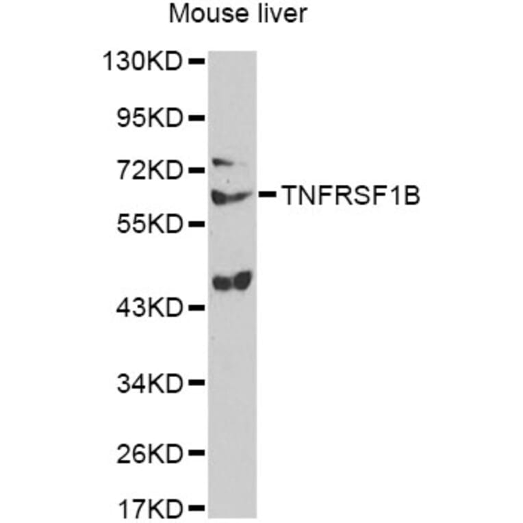Western Blot - Anti-TNFRSF1B Antibody (A13556) - Antibodies.com