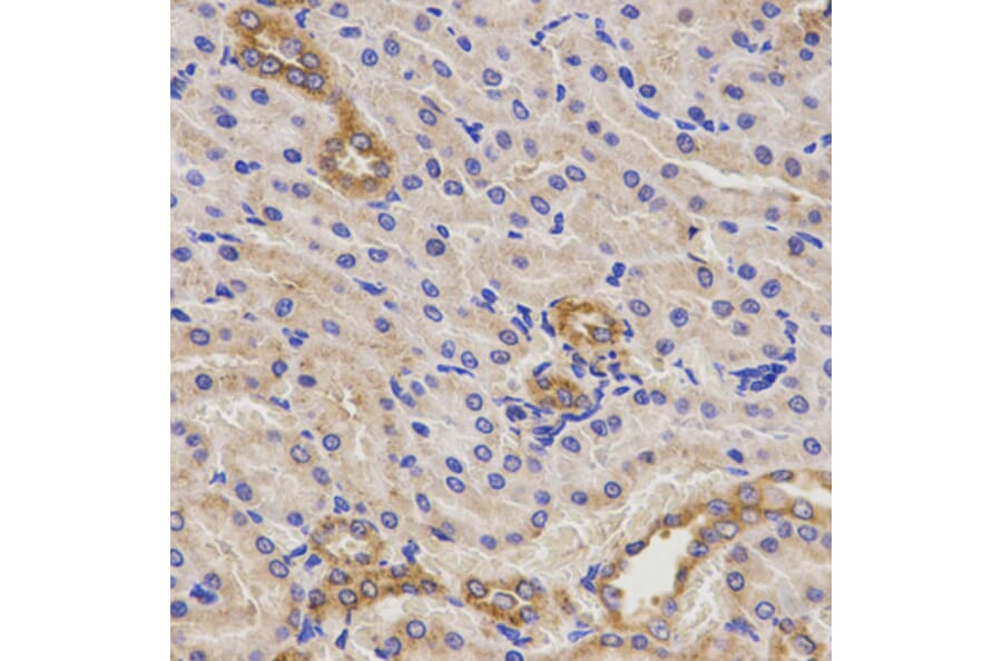 Immunohistochemistry - Anti-TNFRSF1B Antibody (A13556) - Antibodies.com