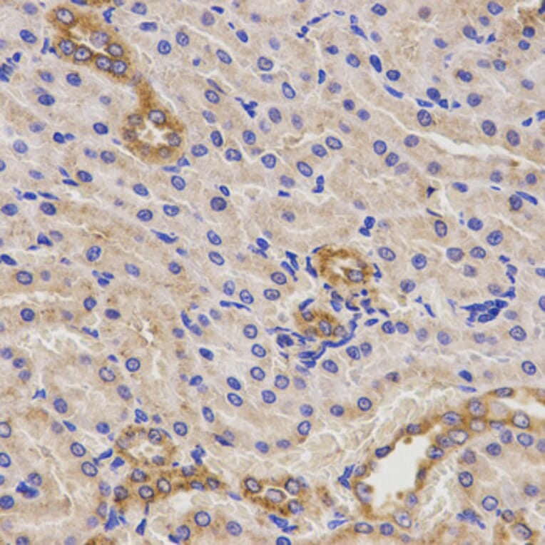 Immunohistochemistry - Anti-TNFRSF1B Antibody (A13556) - Antibodies.com