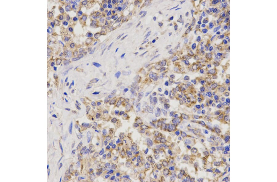 Immunohistochemistry - Anti-TNFRSF1B Antibody (A13556) - Antibodies.com
