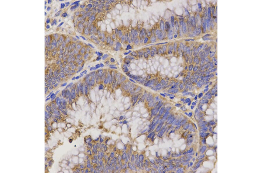 Immunohistochemistry - Anti-TNFRSF1B Antibody (A13556) - Antibodies.com