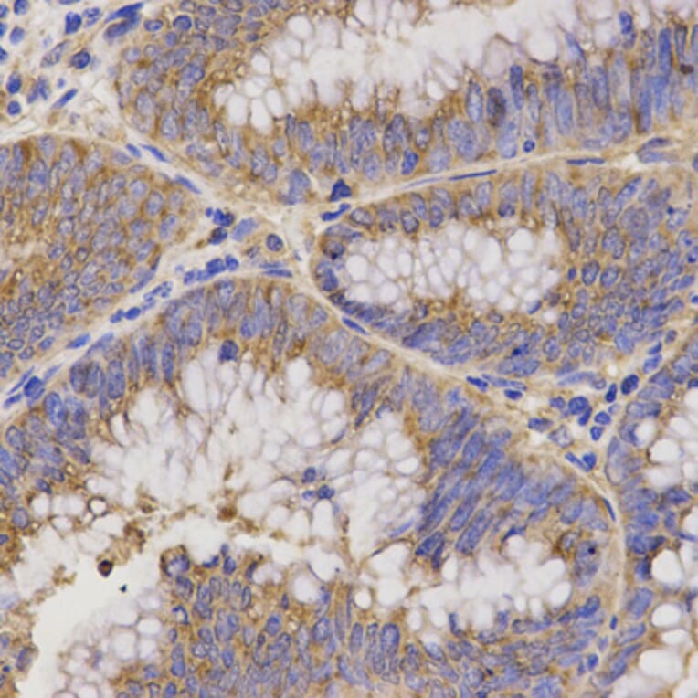 Immunohistochemistry - Anti-TNFRSF1B Antibody (A13556) - Antibodies.com