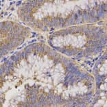 Immunohistochemistry - Anti-TNFRSF1B Antibody (A13556) - Antibodies.com
