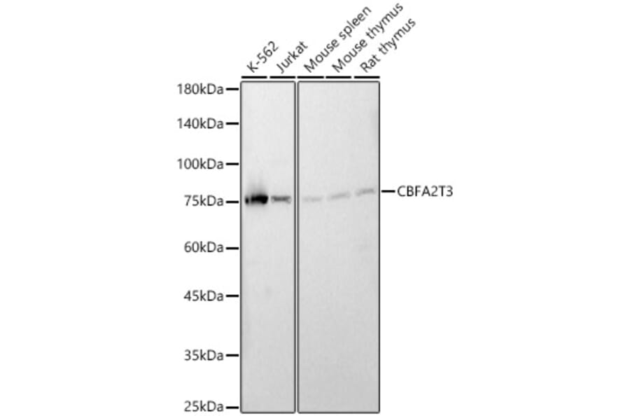 Western Blot - Anti-MTG16 Antibody (A90696) - Antibodies.com