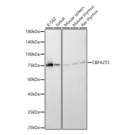 Western Blot - Anti-MTG16 Antibody (A90696) - Antibodies.com