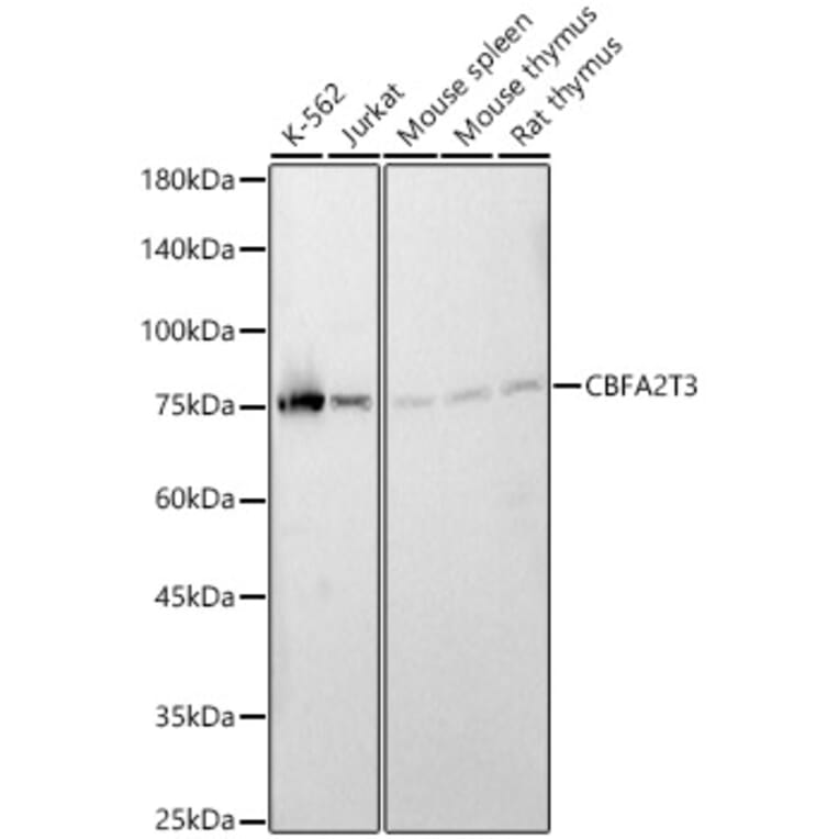 Western Blot - Anti-MTG16 Antibody (A90696) - Antibodies.com