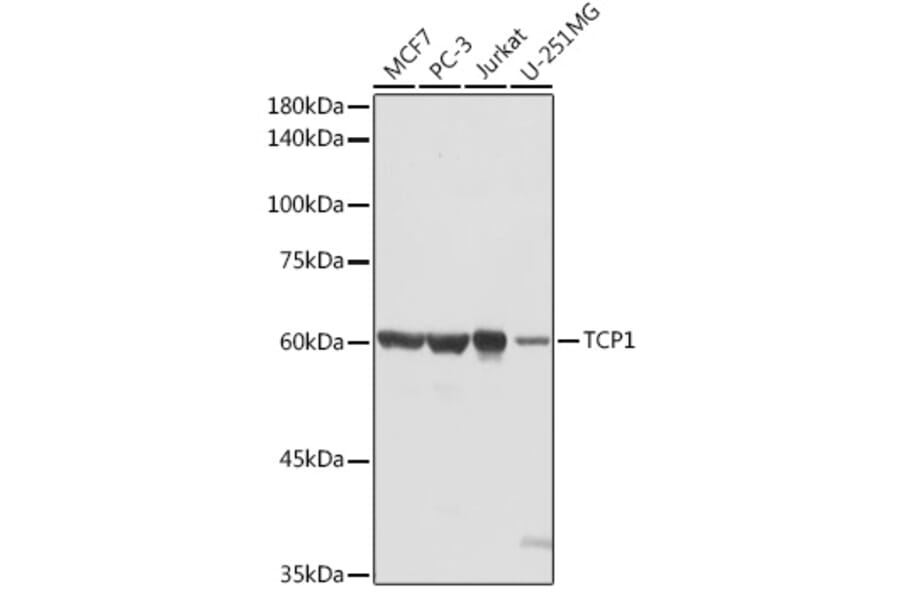 Western Blot - Anti-TCP1 alpha/CCTA Antibody (A90697) - Antibodies.com