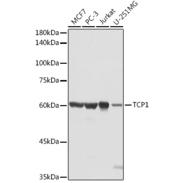 Western Blot - Anti-TCP1 alpha/CCTA Antibody (A90697) - Antibodies.com